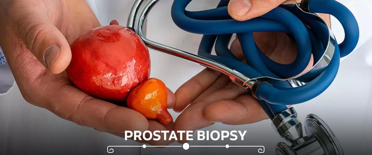 Prostate Cancer Treatment