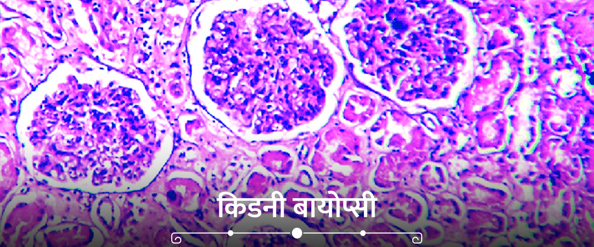 Kidney Biopsy